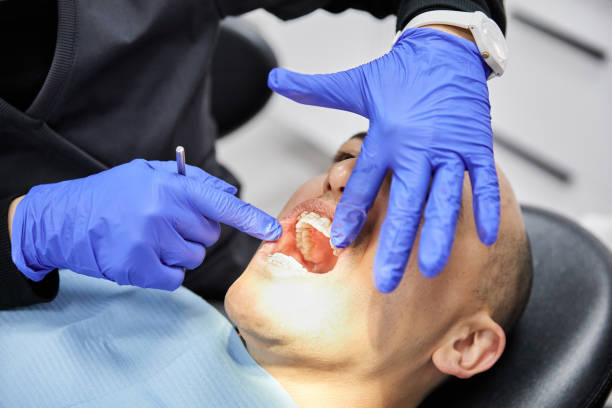 Best Emergency Tooth Extraction in Noroton Heights, CT