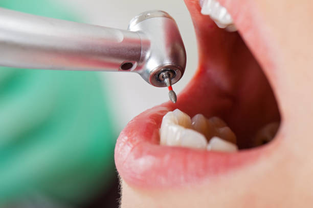 Best Emergency Broken Tooth Repair in Noroton Heights, CT